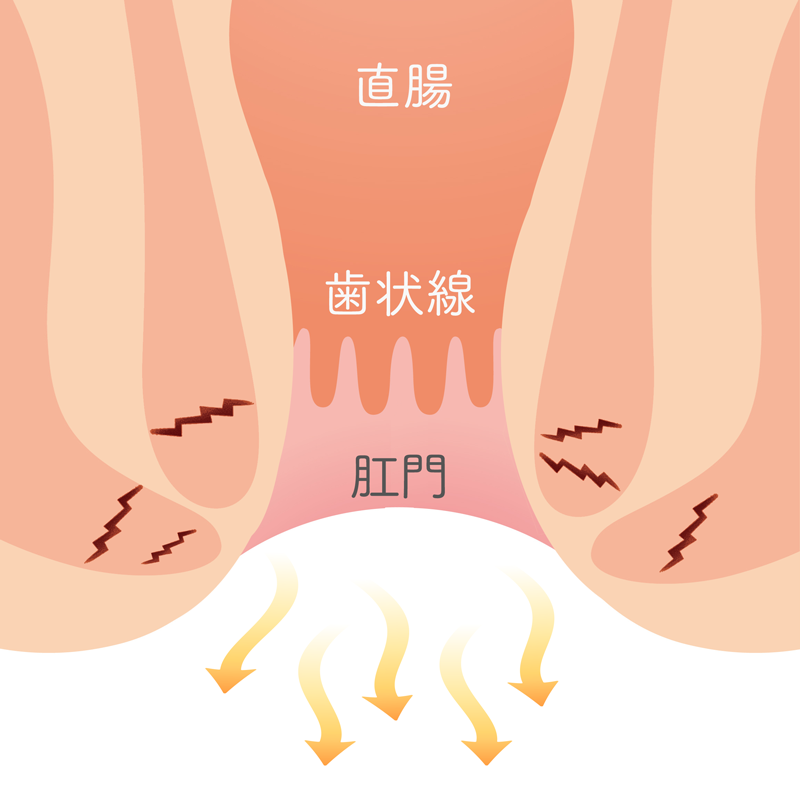 括約筋 